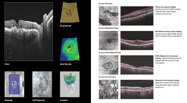 Diagnostic | Natandeep Eye Hospital