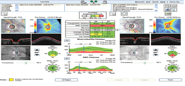 Diagnostic | Natandeep Eye Hospital