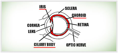 uveitis-1.jpg | Nayandeep Eye Hospital