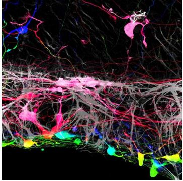 A rift in the retina may help repair the optic nerve